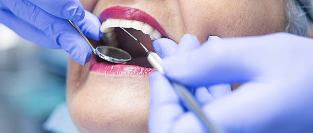 Best Emergency Dental Care for Abscessed Tooth in Hampshire, IL